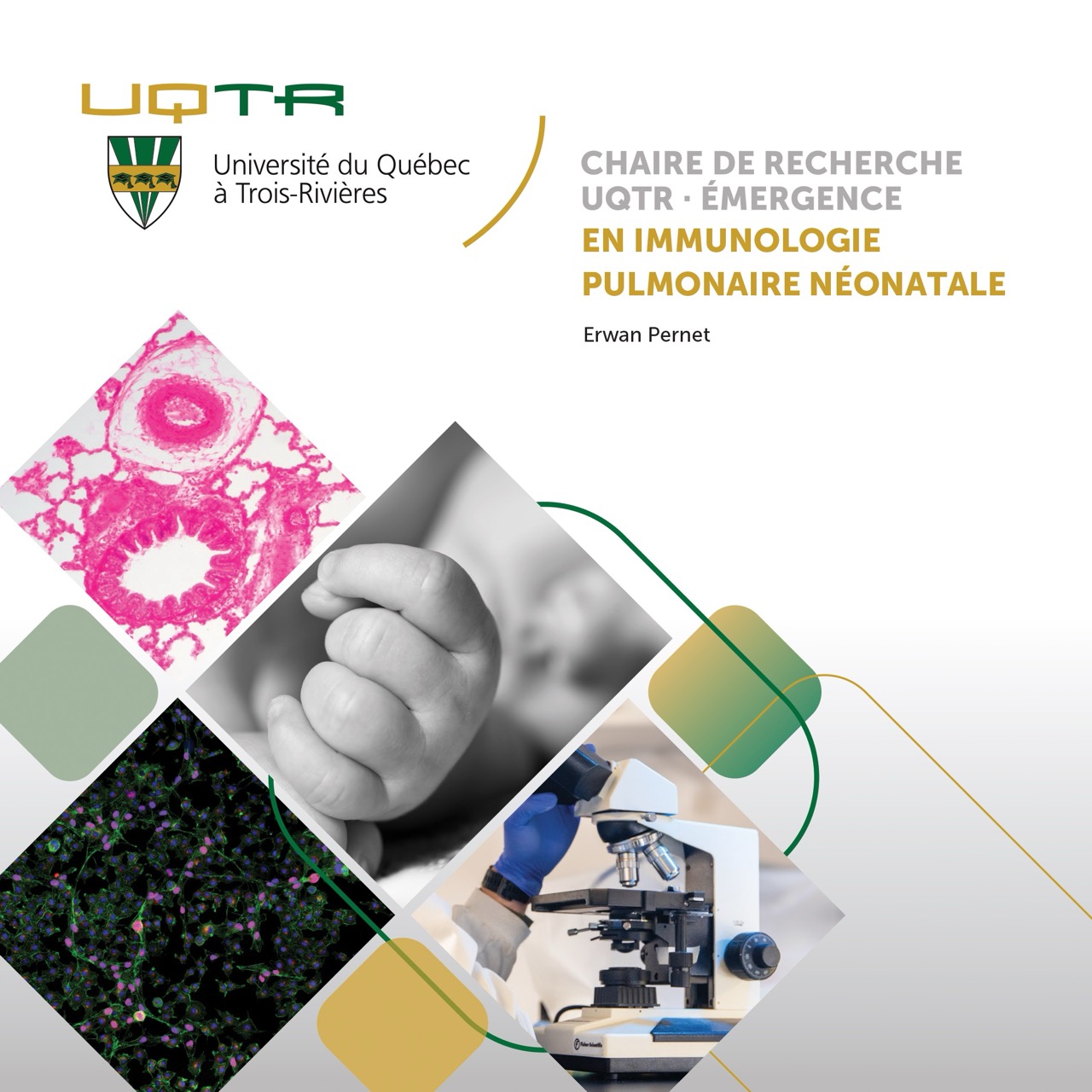Chaire de recherche UQTR Émergence en immunologie pulmonaire néonatale